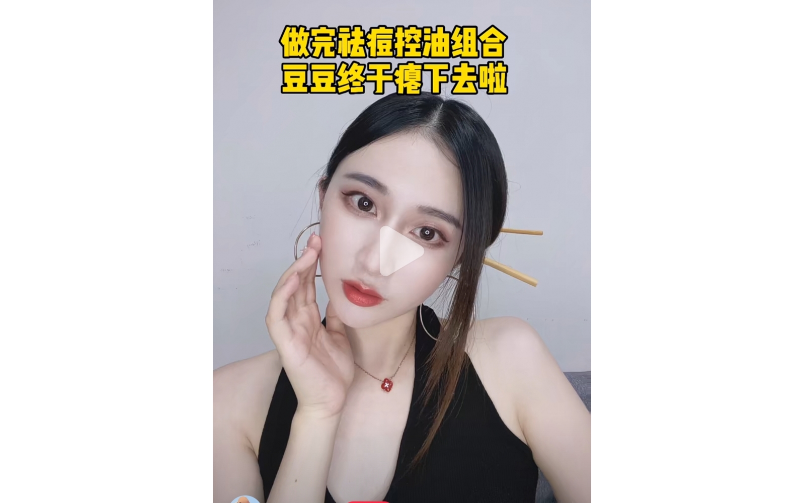 豆豆肌有(yǒu)救啦｜伊膚泉控油祛痘微針yyds